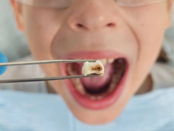 Best After-Hours Emergency Dentist in Poplarville, MS